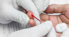 На 1 август тестват безплатно за хепатит В и С в Поликлиниката