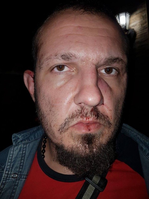 Полицията задържа един по един нападателите от снощния побой между цигани и българи в Дунавци / Новини от Казанлък
