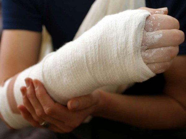 36-годишен е със счупена ръка след побой  / Новини от Казанлък