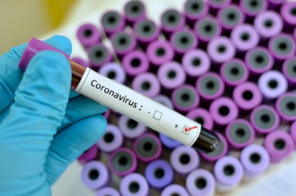 Разкриват лаборатория в Стара Загора за изследване за коронавирус / Новини от Казанлък