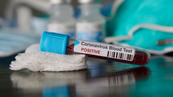 Четири случая на коронавирус в България / Новини от Казанлък