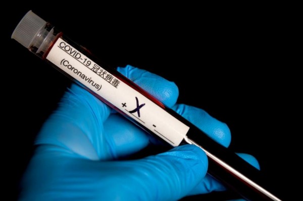 23 проби за коронавирус са изследвани днес в Старозагорско / Новини от Казанлък