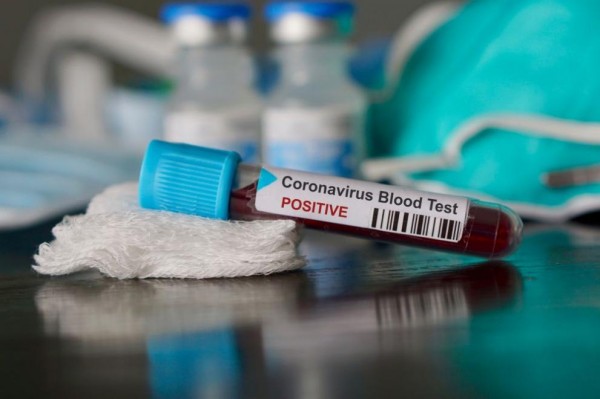 Нов положителен тест за коронавирус в Паничерево. Днес започва масовото изследване / Новини от Казанлък